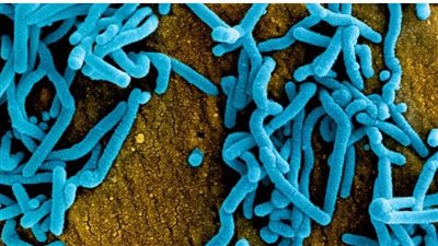 بعد تحذير الصحة العالمية.. تنزانيا تنفي تفشي فيروس ماربورغ 