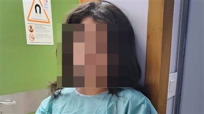 هددتها بفقأ عينيها.. ولية أمر تستغيث: بنتي اتضربت من زميلتها بآلة حادة على راسها في مدرسة أجنبية شهيرة بالقاهرة