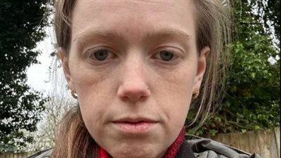 تتقيأ 60 مرة يوميا.. بريطانية تعاني من حالة نادرة تجبرها على الوقوف خلال تناول الطعام 