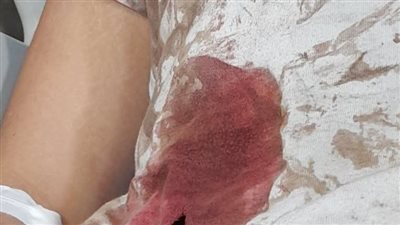 منعهوه من معاكسة زميلتهم.. طالب يطعن 3 طلاب بمدرسة دولية في الإسكندرية بعد خروجهم من درس خصوصي