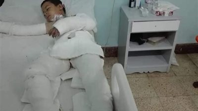 محامي الطفل ضحية التنمر والحرق بالمنوفية: أهل المتهم الثالث قاموا بتسليمه للنيابة