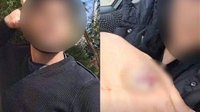 قالولي جوزك مات واطلعي بره البيت.. أول تعليق من الطبيبة ضحية الاعتداء من أقارب زوجها بـ أكتوبر