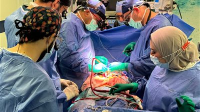 أول عملية من نوعها في العالم.. جامعة المنصورة تحقق إنجازًا طبيًا بجراحة القلب