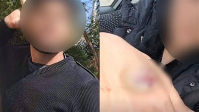 تأجيل أولى جلسات دعوى عدم تسليم الميراث للطبيبة المعتدى عليها من أهل زوجها بأكتوبر