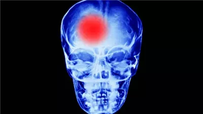 دراسة: البكتيريا الموجودة في الفم والأمعاء تزيد من خطر الموت المفاجئ