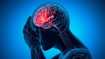 نصائح لتحسين صحة الشرايين وللحد من السكتات الدماغية والنوبات القلبية..تعرف على التفاصيل