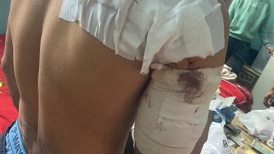 جهود مكثفة للقبض على طالبين بعد اعتدائهما على شابين بالأسلحة البيضاء في السويس