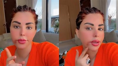 قلقت على أمي.. شمس الكويتية تكشف إصابتها بـ فيروس وورم في الفم