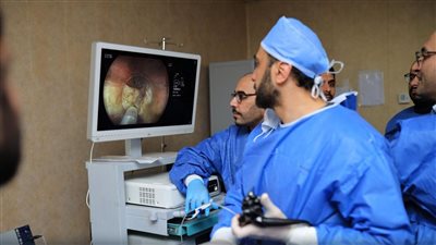 مستشفى كفر الشيخ الجامعي يطلق تقنية مناظير الفراغ الثالث لعلاج أمراض الجهاز الهضمي