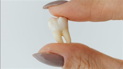 تفسير حلم سقوط الأسنان في اليد بدون ألم.. ماذا يعني لرؤيتك؟