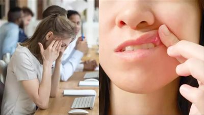 كيف يؤثر التوتر على صحة الجلد؟.. استشاري يوضح