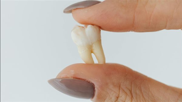  تفسير حلم سقوط الأسنان