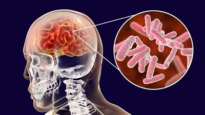 أبرزها المشروبات الغازية.. منتجات غذائية سريعة تضر بصحة الدماغ | دراسة 