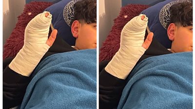 والد طالب بـ مدرسة دولية يستغيث بعد اعتداء مدرس على ابنه: دراعه اتكسر وأجبروه يمضي على ورقة أنه غلط في المدرس