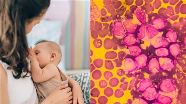 الرضاعة الطبيعية