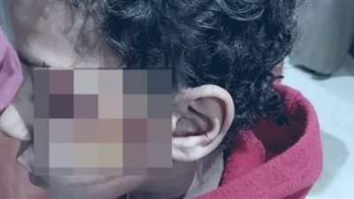 إحالة واقعة إصابة طالب مدرسة مجمع شطورة في سوهاج للنيابة الإدارية| بث مباشر 