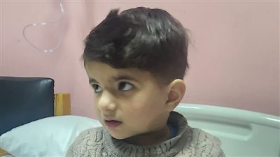 استغرقت 5 ساعات.. نجاح إجراء أول جراحة قلب مفتوح لطفل من غزة بمستشفى أبو الريش الياباني