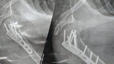 11 مسمارًا وشريحة وقطع وتر.. سائق يتعمد قلب التوكتوك بسبب رفض سيدة دفع أجرة إضافية