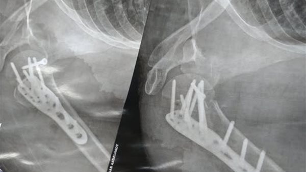 سيدة تتعرض لإصابات