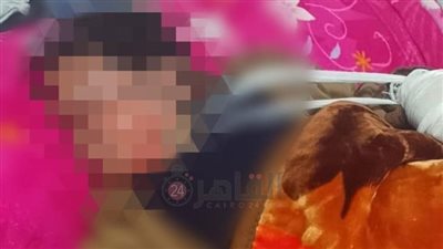 بسبب الألعاب النارية.. إصابة صغيرة بحروق بالوجه واليدين في الفيوم