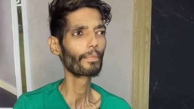 تفاصيل الحالة الصحية لـ إبراهيم شيكا لاعب الزمالك بعد نقله إلى الرعاية المركزة