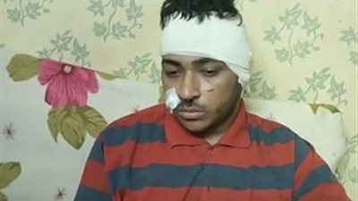 إصابة شاب على يد أعمامه بالعمرانية بسبب كلب: أخدت 200 غرزة| بث مباشر