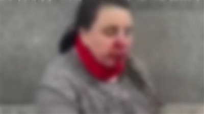 كانت في زيارة لوالدتها.. فرد أمن بمستشفى الأزهر يعتدي على سيدة بالضرب في دمياط