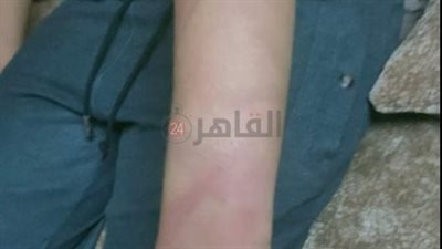 السجن عامين لدكتورة بجامعة حلوان لاتهامها بالتعدي على نجل زوجها