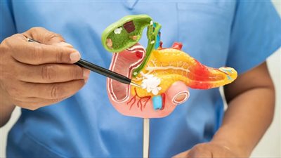 علامات تحذيرية مبكرة لسرطان البنكرياس .. تعرف عليها  