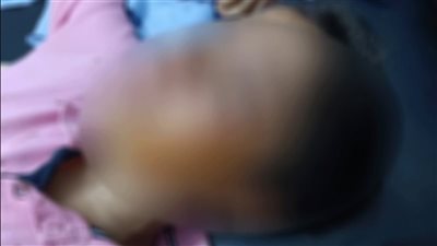 غششني لأعورك.. طالب يستعين بوالده لإصابة زميله بـ 27 غرزة في وجهه أمام مدرسة بالبدرشين | فيديو وصور