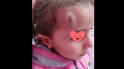 مصدر بالقومي للطفولة: سنتخذ الإجراءات القانونية بواقعة التعدي على طفلة ووالدتها بالنزهة لتناولهما الطعام بنهار رمضان