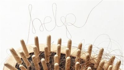 دراسة: جرعات منخفضة من مضاد حيوي شهير قد تكون الحل لتساقط الشعر المرتبط بالثعلبة