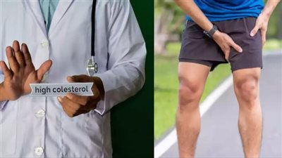 تظهر عند المشي.. علامات ارتفاع مستويات الكوليسترول بالدم 