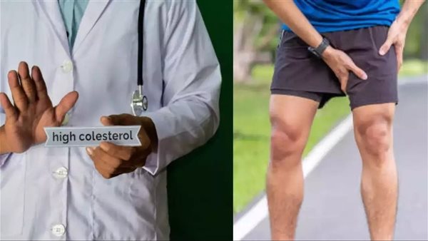 أعراض ارتفاع الكوليسترول