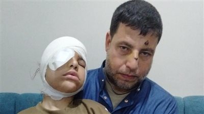 بعد فقدان صغيرة من ذوي الهمم عينها.. محليات المنوفية تحذر من رشق القطارات بالحجارة