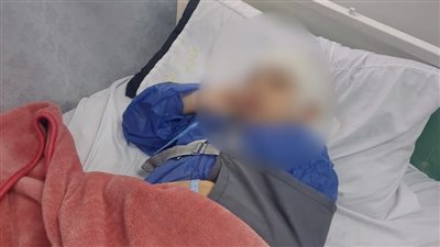 تطورات الحالة الصحية لضحية حادث دهس سيارة ملاكي داخل جراج مول شهير بالإسكندرية