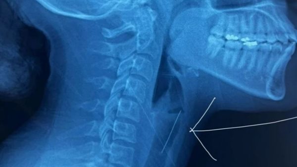 صورة إشاعة مقطعية