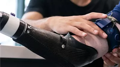 ثورة تكنولوجية تعيد الأمل لمبتوري الأطراف الصناعية