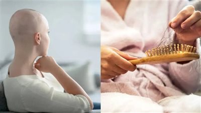 تعرف على الوقت المستغرق لنمو الشعر بعد علاج السرطان؟