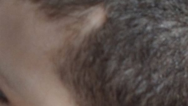 الطفل المعتدى عليه