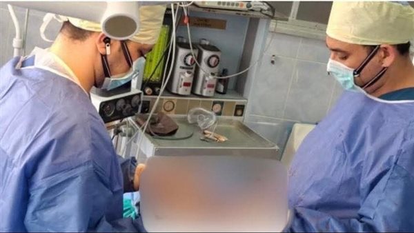 خلال العملية الجراحية