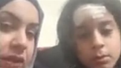 ولية أمر طالب تشكو إصابته في مشاجرة بمدرسة بالإسكندرية: زميله ضربه وجرح جبهته | بث مباشر 