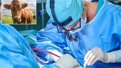 NHS تعتمد جلد الأبقار لعلاج جروح الوجه الناتجة عن سرطان الجلد