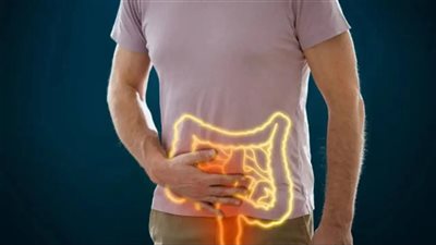  تهدد الشباب بسرطان القولون.. تحذير طبي عالمي بشأن اللحوم المصنعة