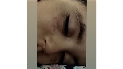 لو قعدت أطبطب عليه مش هشتغل| أسرة تزعم تعرض طفلها للعنف في مركز تأهيل.. ومديرته: كله مسجل بالكاميرات