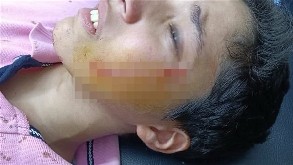 المجني عليه