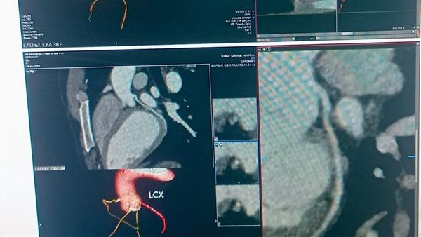 جانب من الأشعة