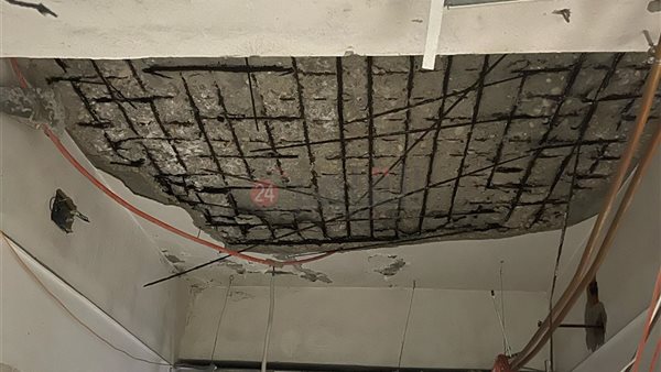 مبني الغسيل الكلوي