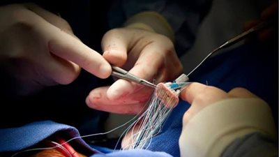 بجراحة استمرت 7 ساعات.. نجاح الفريق الطبي بمستشفى شرق المدينة بالإسكندرية في إنقاذ حياة مُسنة