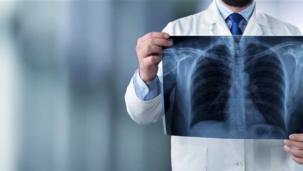 مستشفى الصدر - تعبيرية